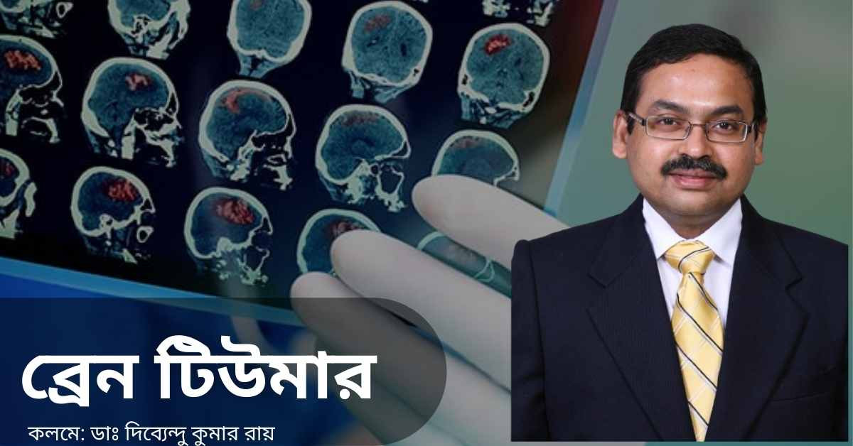 what is brain tumor and how it is treated ? here is a special article from Dr. Dibbendu Kumar Roy .