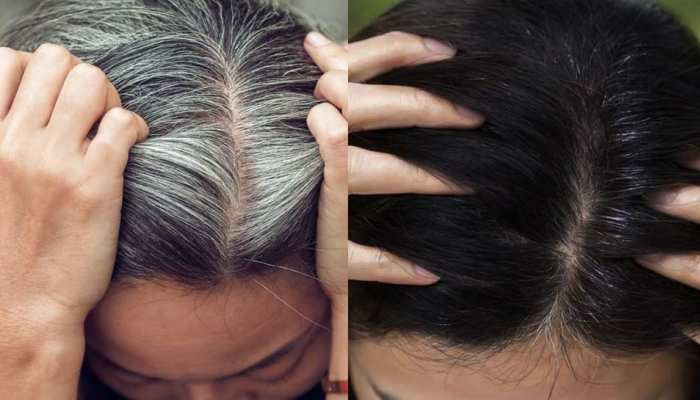 Gray Hair  Solution