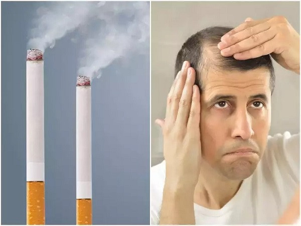 Hair fall can be cause of smoking (File Picture)