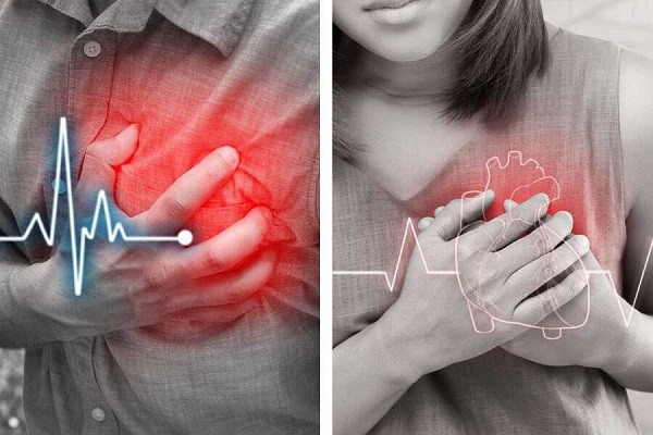 Reasons Behind Silent Heart Attack