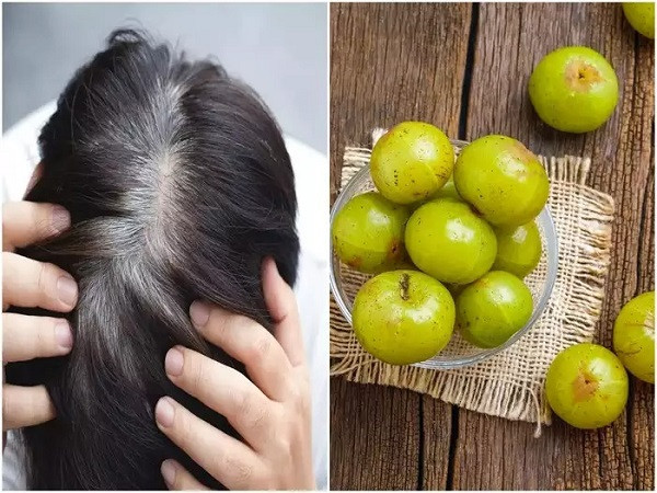 After reaching 20, head full of mature hair, amlaki juice can be useful