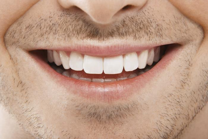 Gap teeth