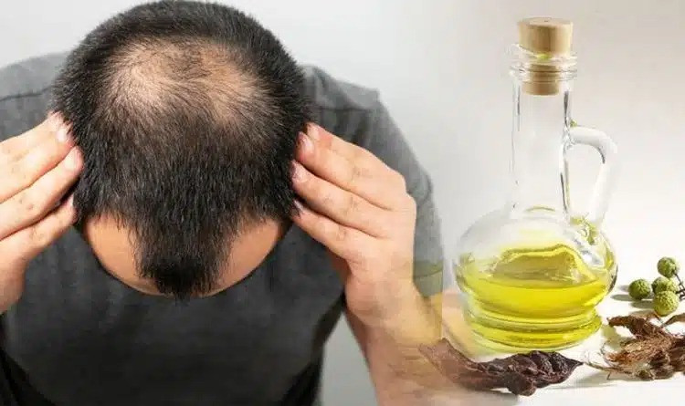 Hair Regrowth Oils