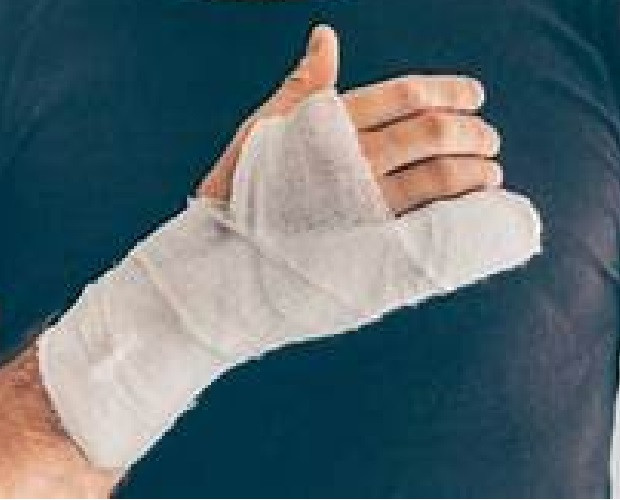 Disturbance over taking classes, the headmaster broke his finger by beating the co-teacher