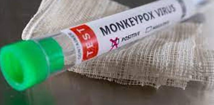 Monkeypox in Pakistan