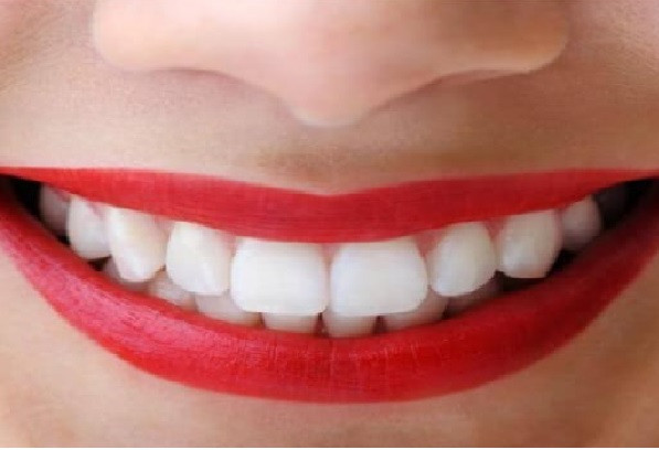 Teeth Tips (Symbolic Picture)