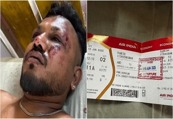 Plane Crash Survivor Ramesh Vishwas Kumar