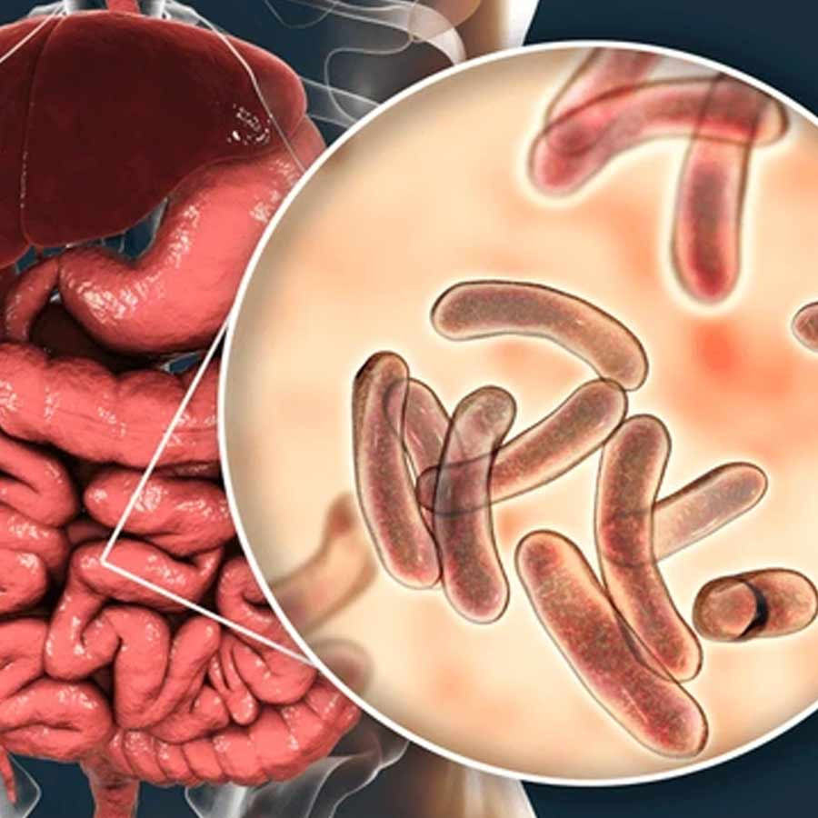 monsoon diseases