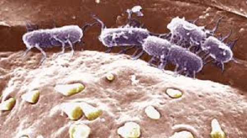 typhoid outbreak 2025