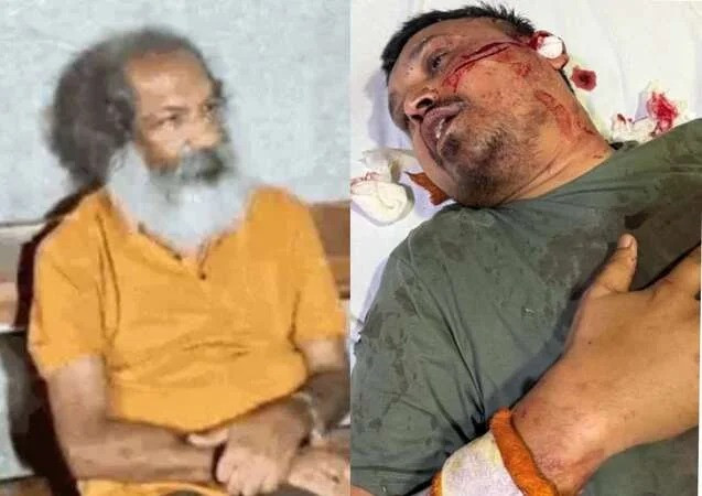 Former Youth Congress president Ashish Shinde attacked with a blade-cutter, condition critical