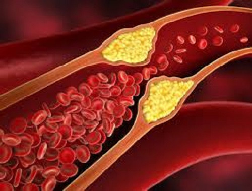 drink to lower cholesterol