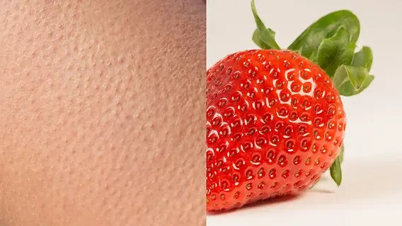 strawberry skin treatmen