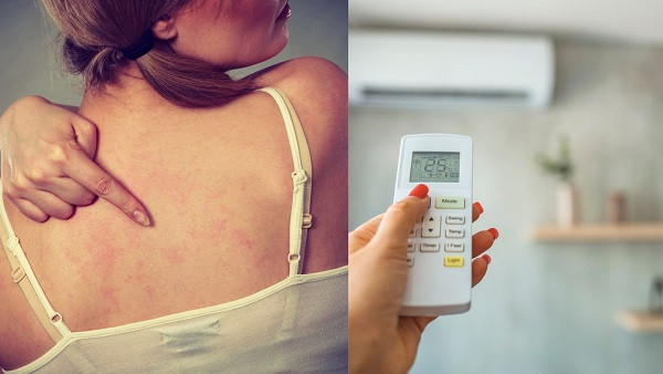 AC Effect on Skin