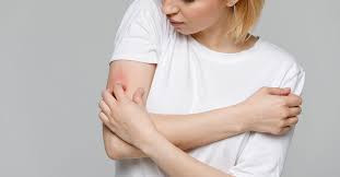 Perfume Allergy