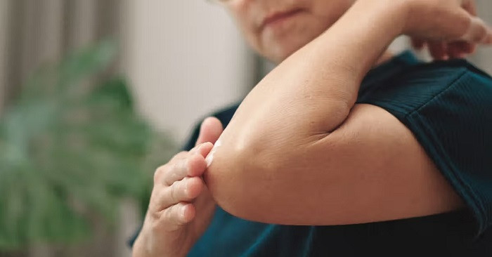 Dark Elbows Knees Home Remedies Puja 2026