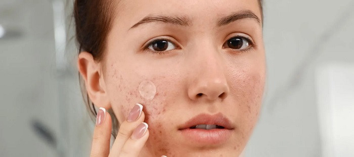 Pimple Patch Acne Care