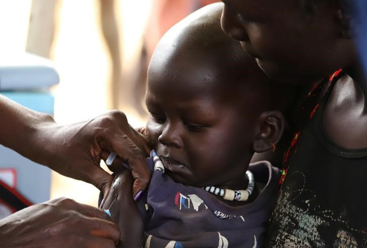 Measles epidemic in Zimbabwe, 80 children dead