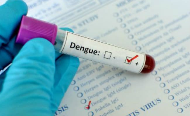 20 dengue case in Delhi on august